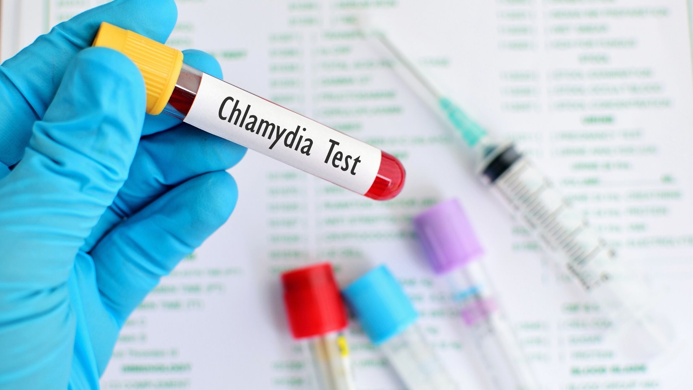 chlamydia choroba leczenie