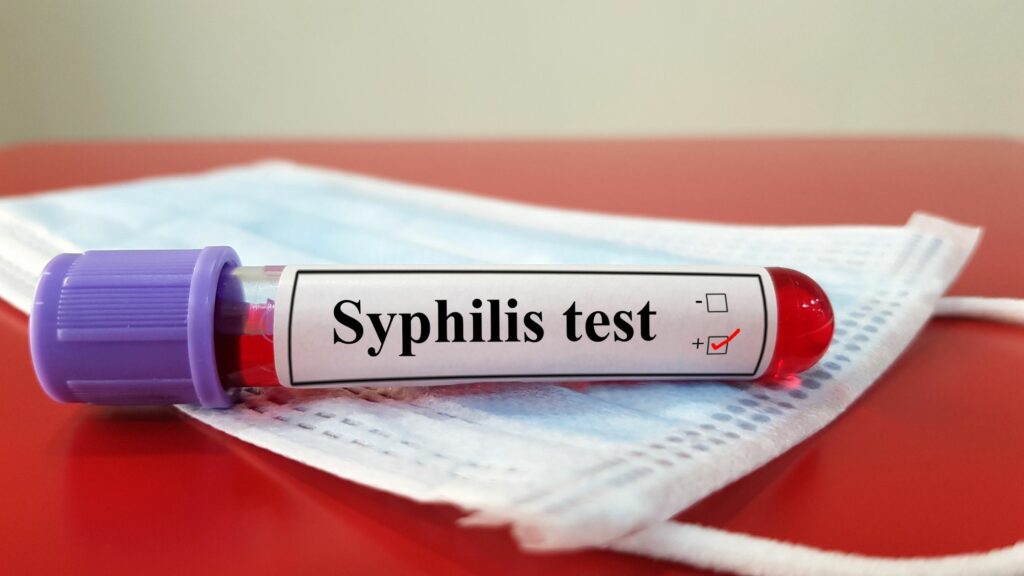 syfilis kiła